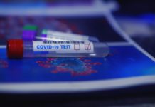 Test sierologico Covid-19