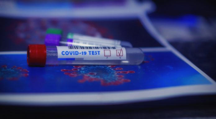 Test sierologico Covid-19