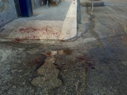 Il sangue sull'asfalto